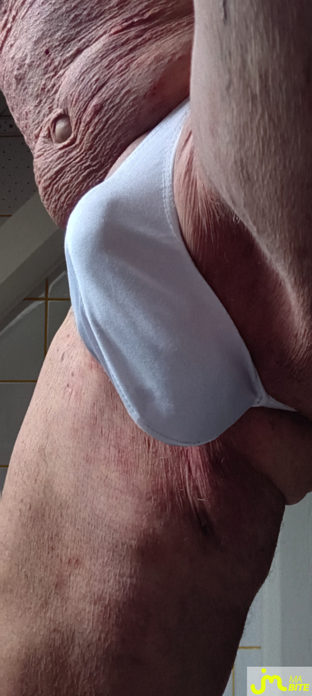 bites de Plastic 3157