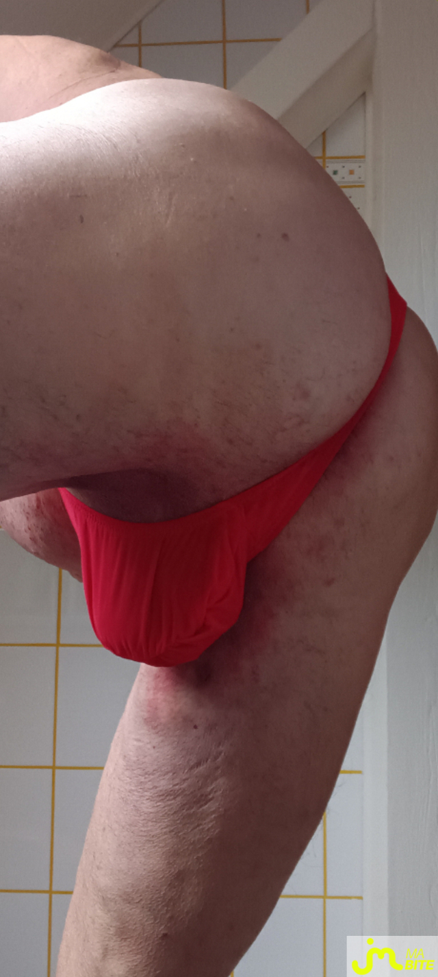 bites de Plastic 3157