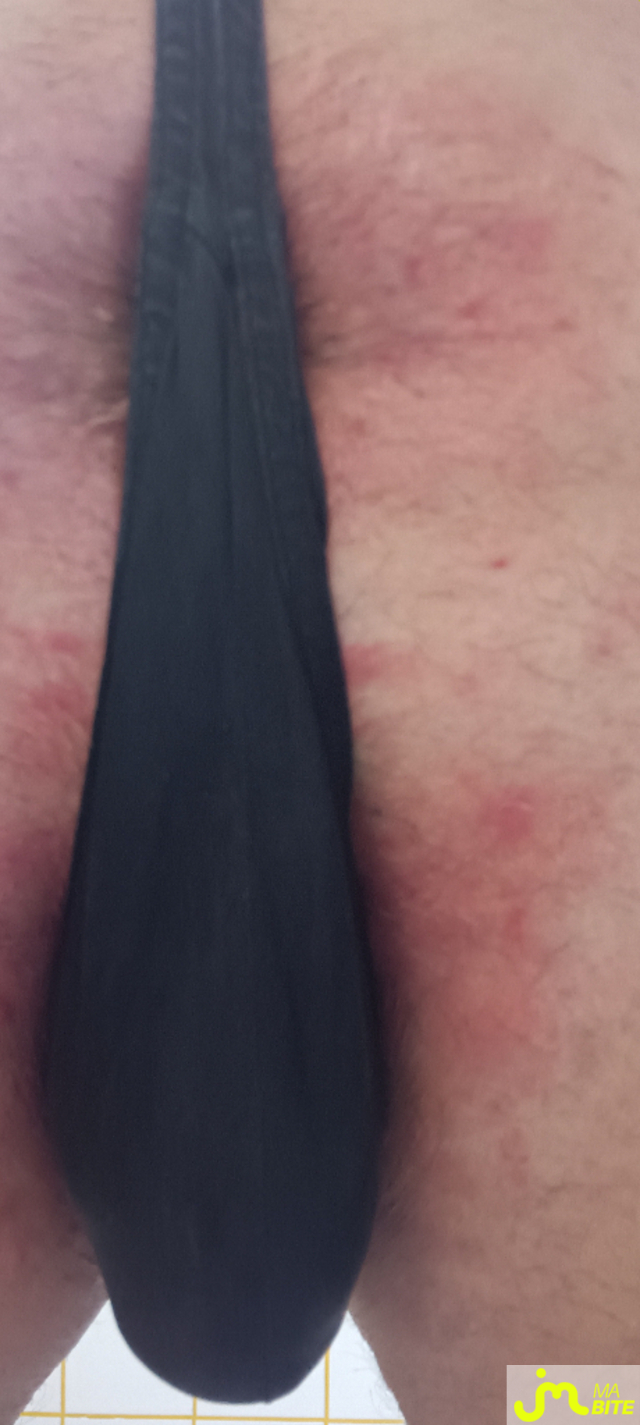 bites de Plastic 3157