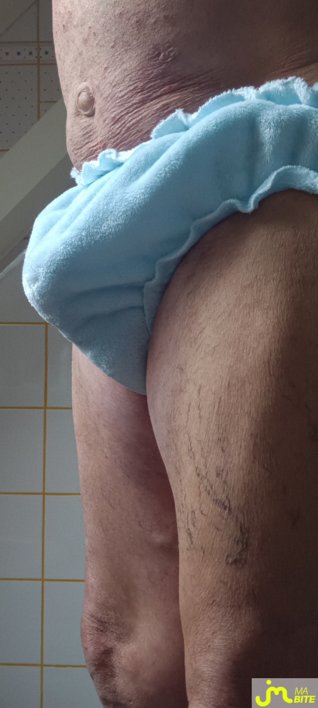 bites de Plastic 3157