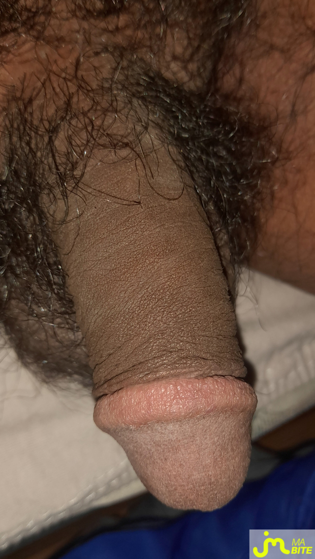 bites de Ericoup&eacute; 