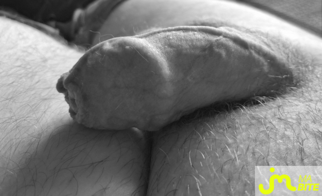 bites de Petitjouet76