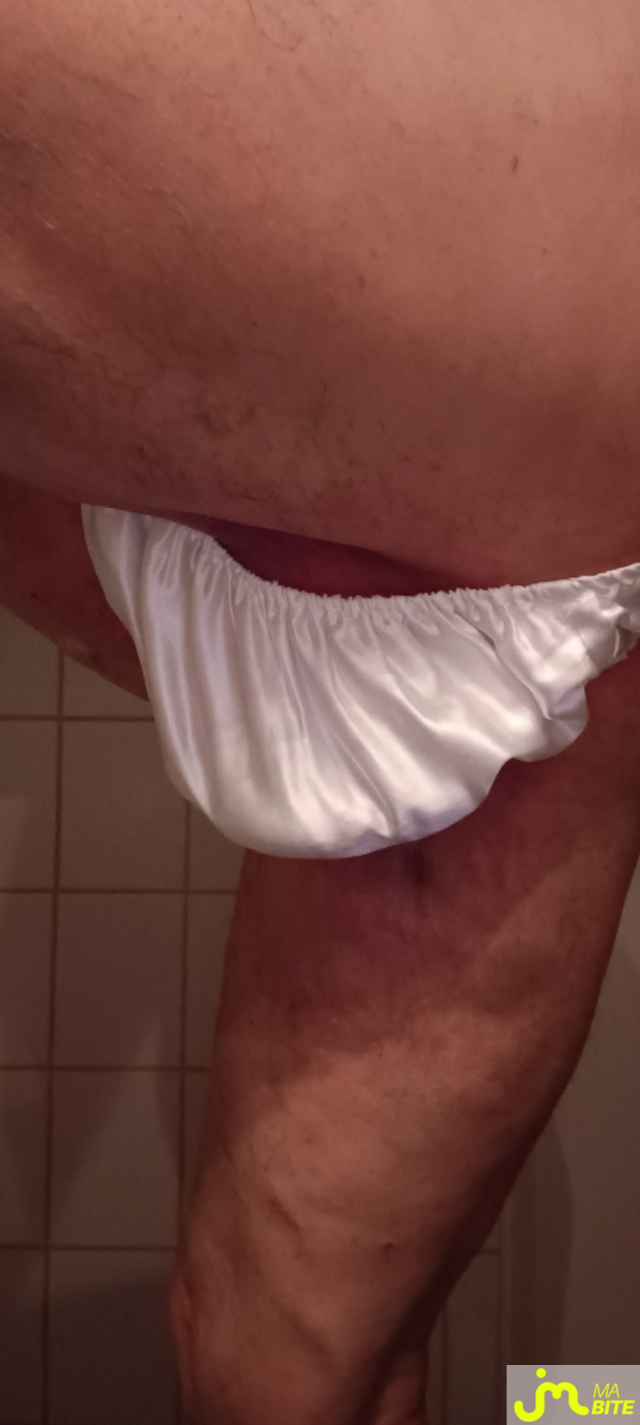 bites de Plastic 3157