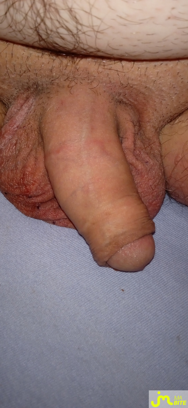 bites de J'aimelabiteetpiss