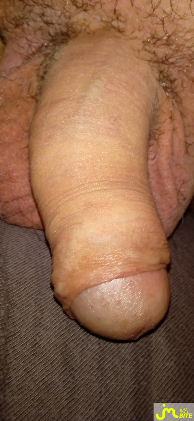 bites de J'aimelabiteetpiss