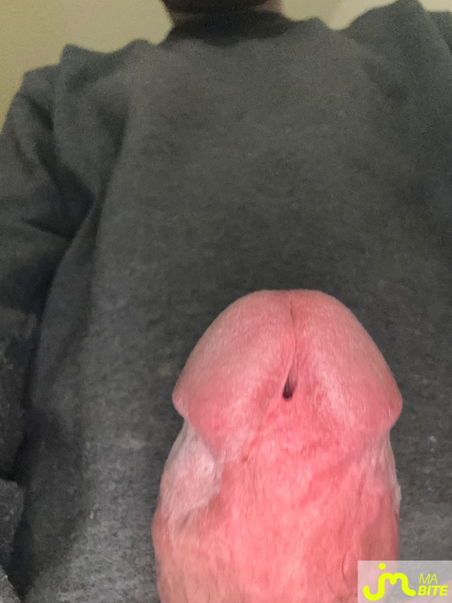 bites de Ziodinamite