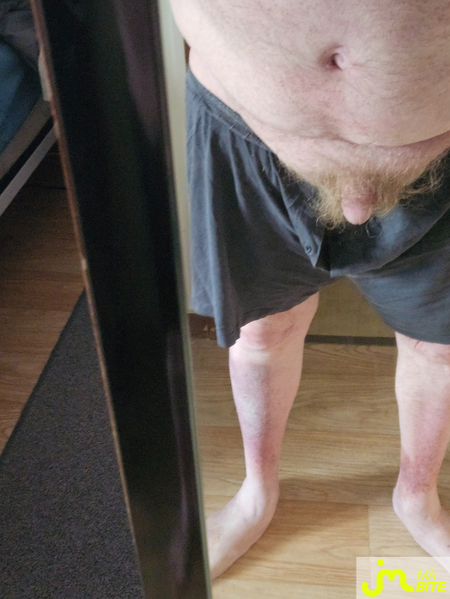 bites de Jean michel89