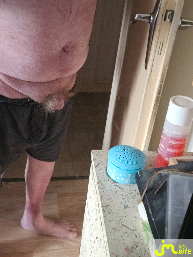 bites de Jean michel89