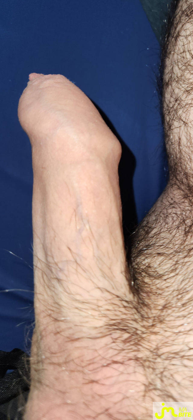 bites de The1camturbator