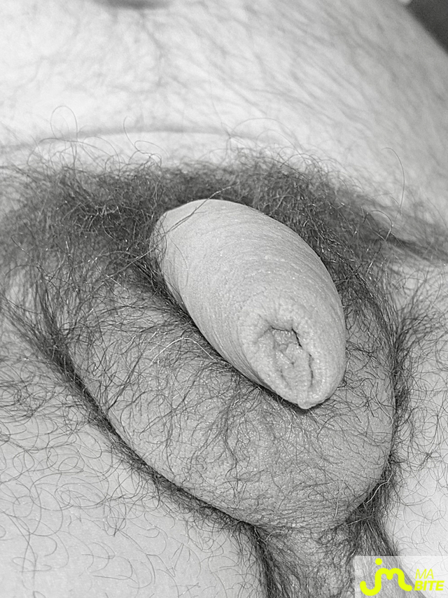 bites de Couplepoilu