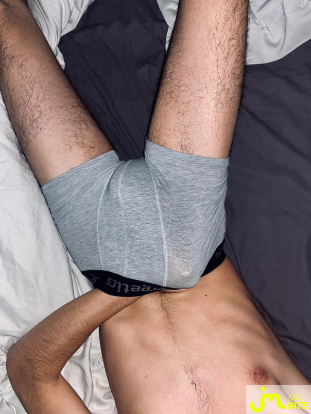 bites de labellegrossebite