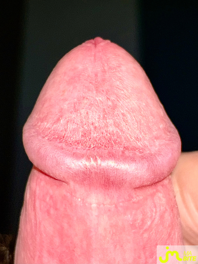 bites de Couplepoilu