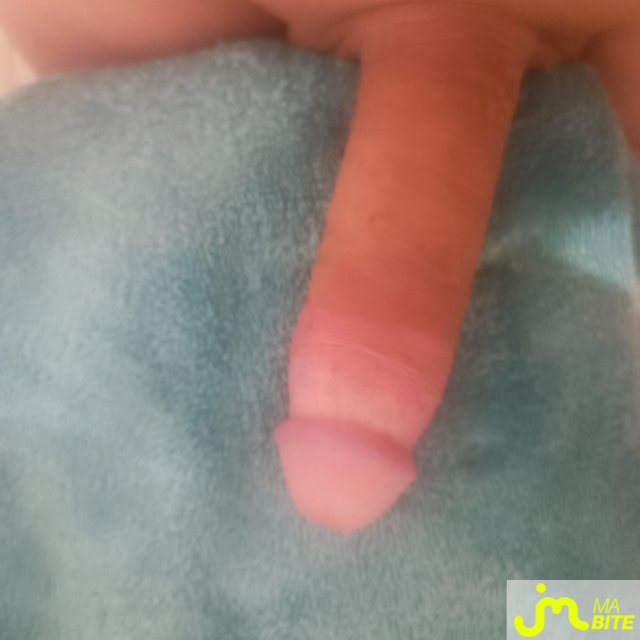 bites de Ragnard142776