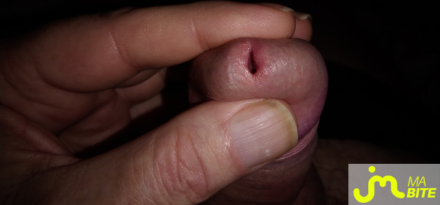 bites de Le brestoas