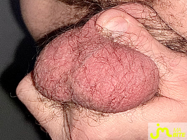 bites de Couplepoilu