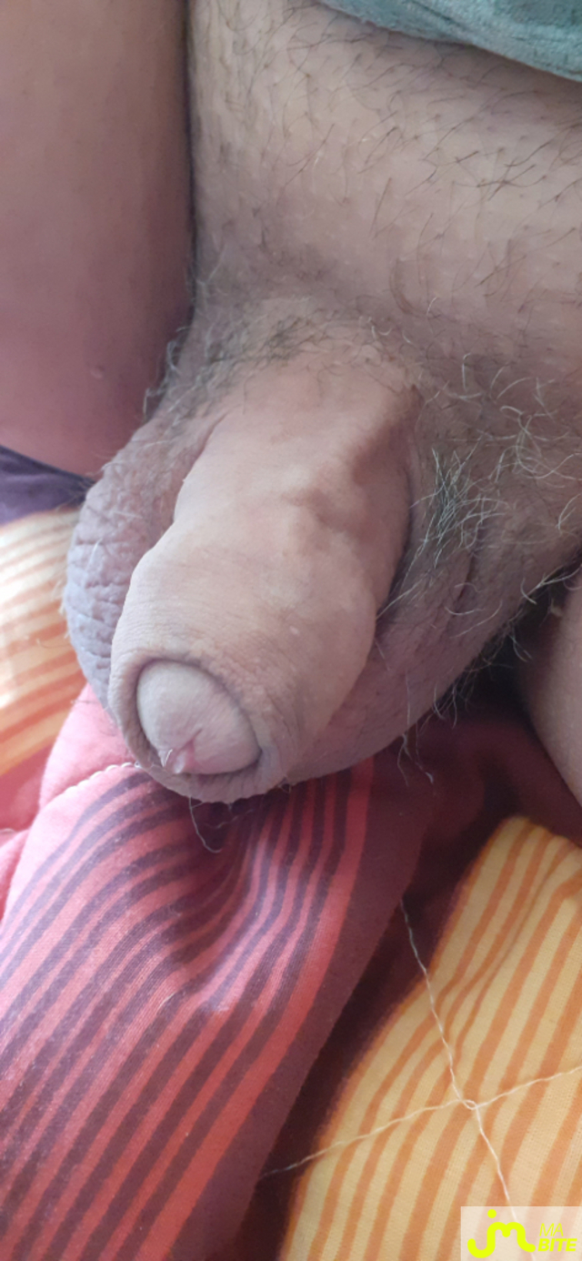 bites de denis 38000