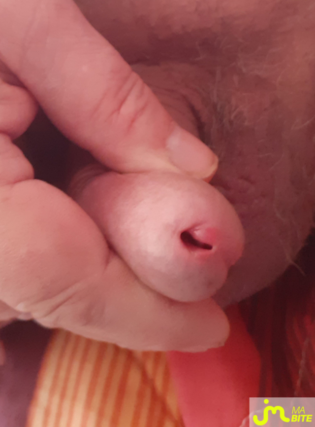 bites de denis 38000