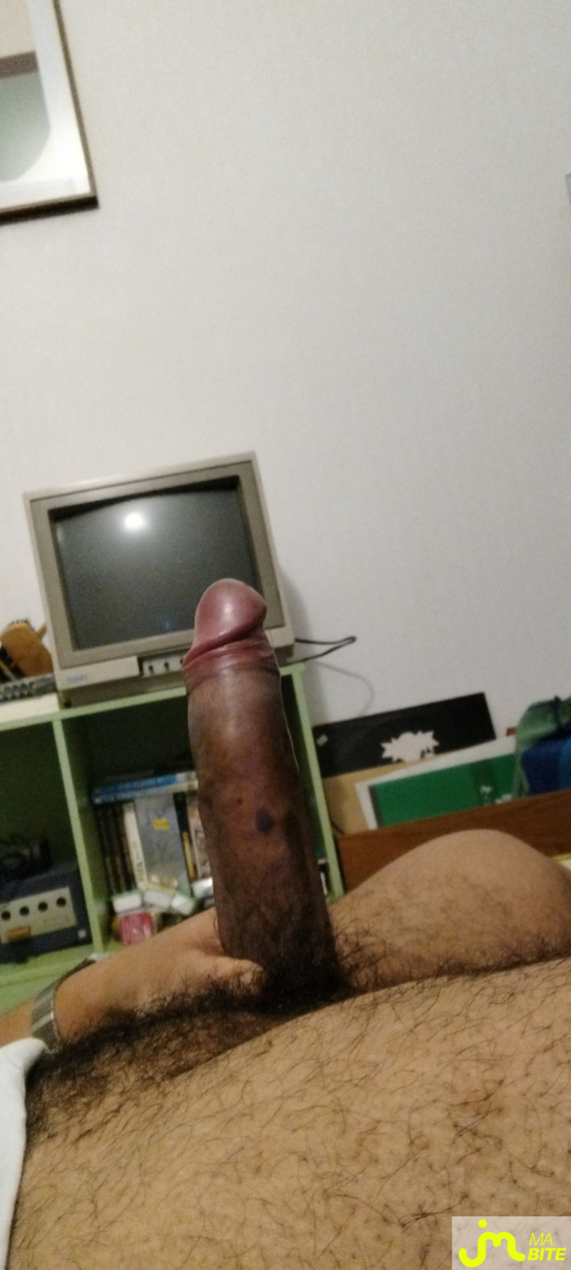 bites de pittbulling