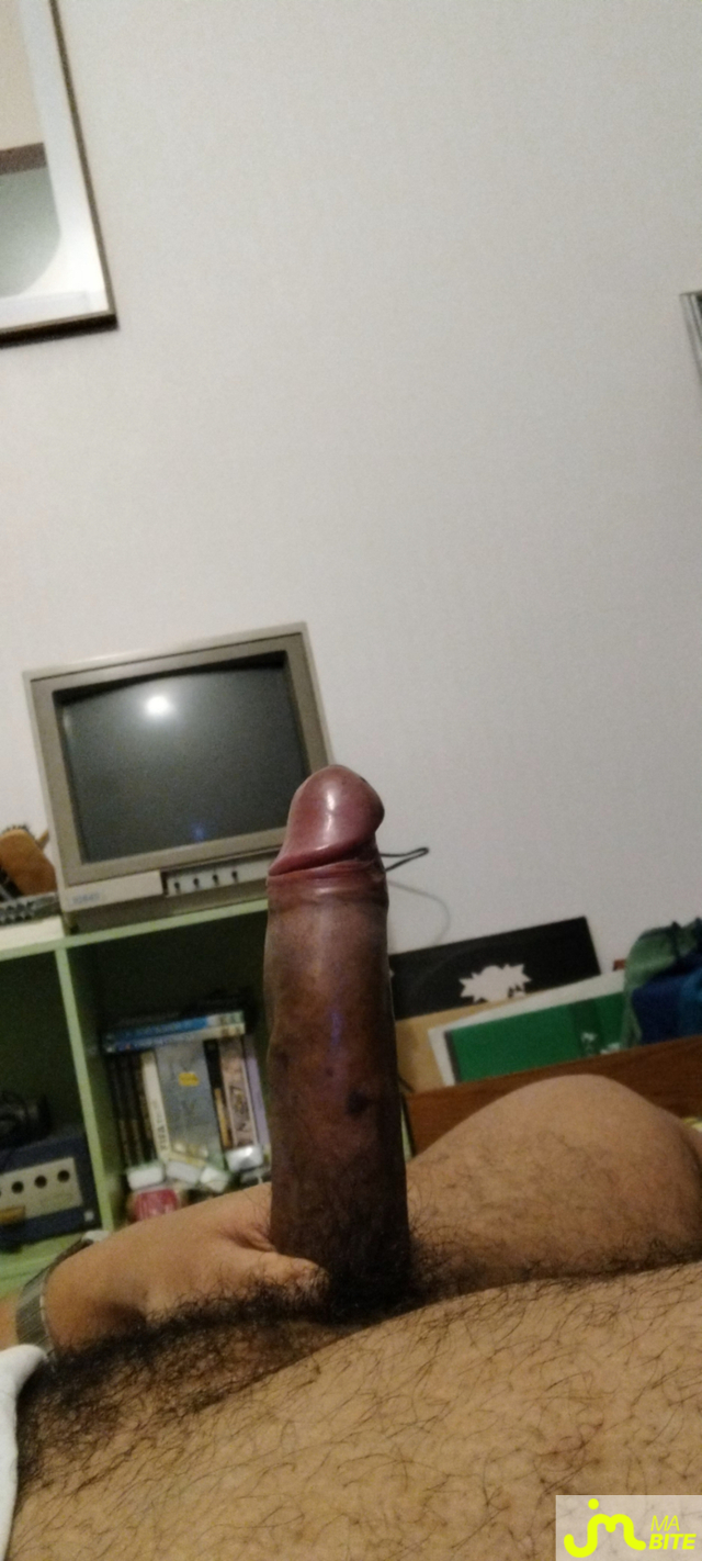 bites de pittbulling