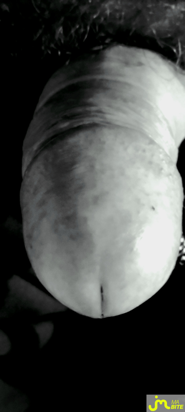 bites de vieuxcochon76