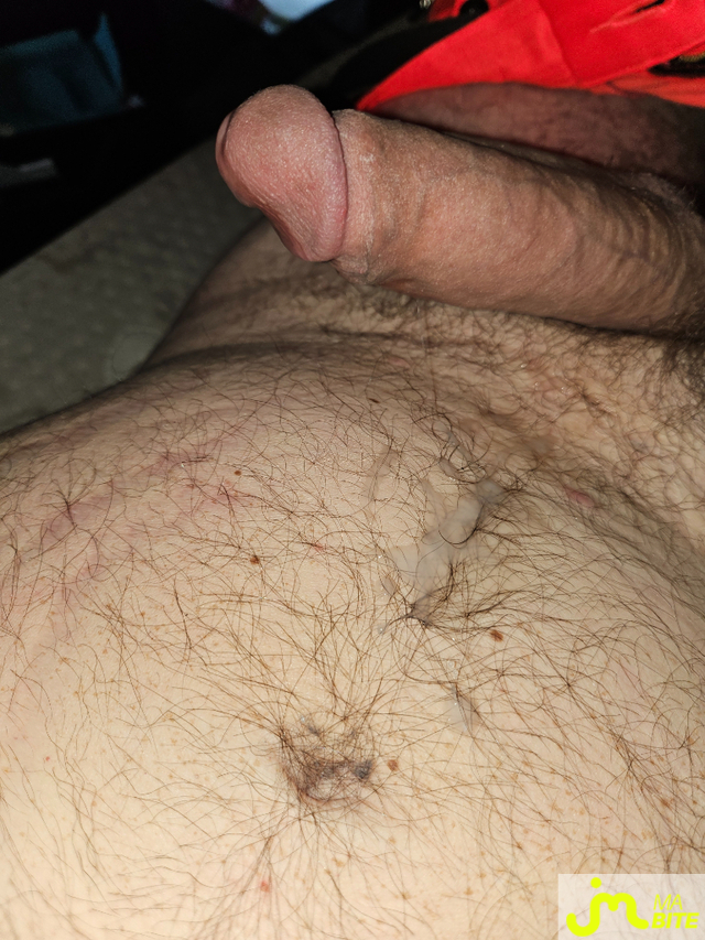 bites de Scaniatorpedo