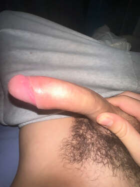 Photos de bites : Bite exit&eacute;