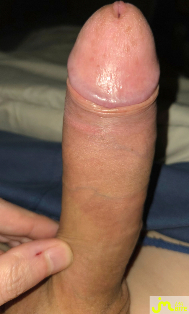 bites de Calvin02000