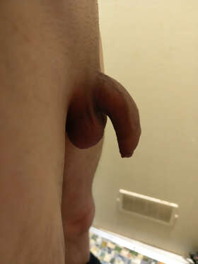 Photos de bites : Premi&egrave;re contribution j'ai toujours &eacute;tais complex&eacute; par mon p&eacute;nis j'attend d'avoir vos retours dite ce que vous en pensez sans l&acirc;cher vos mots 