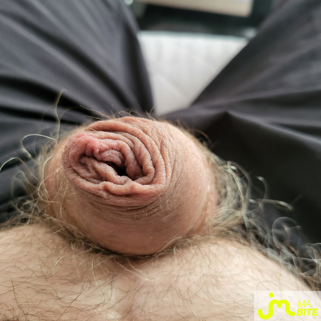 bites de Gland perl&eacute;