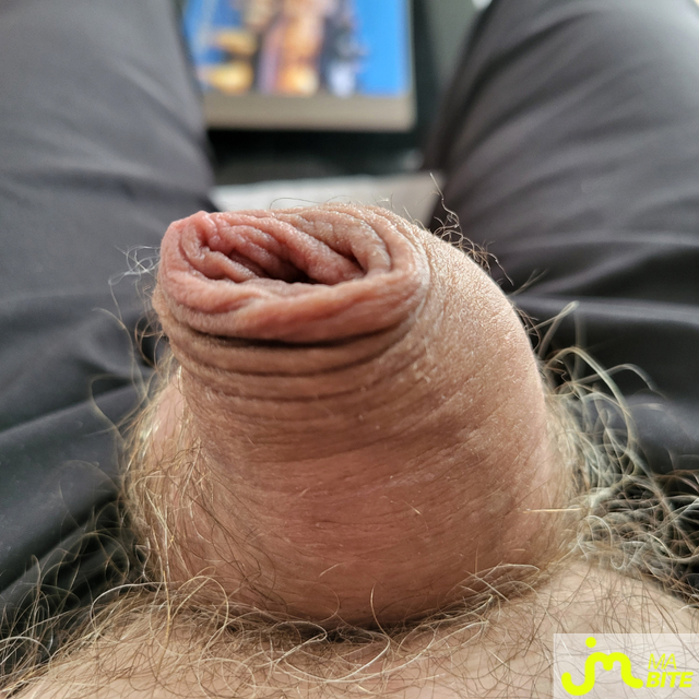 bites de Gland perl&eacute;