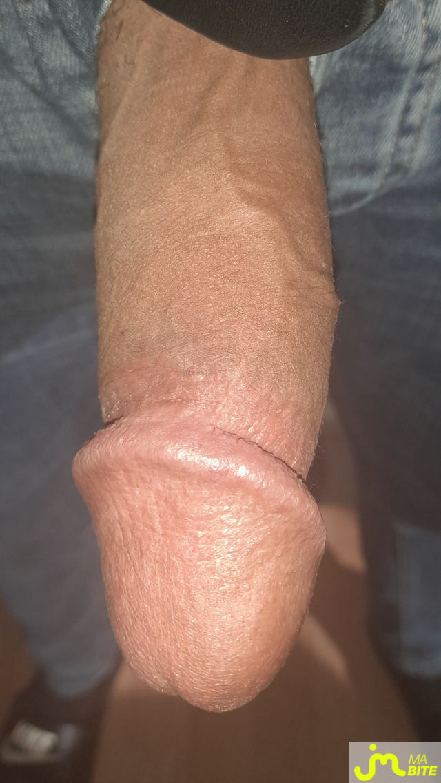 bites de Ericoup&eacute; 