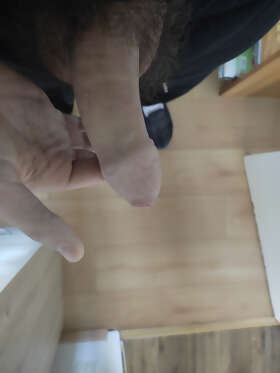 Photos de bites : Evan hemon 