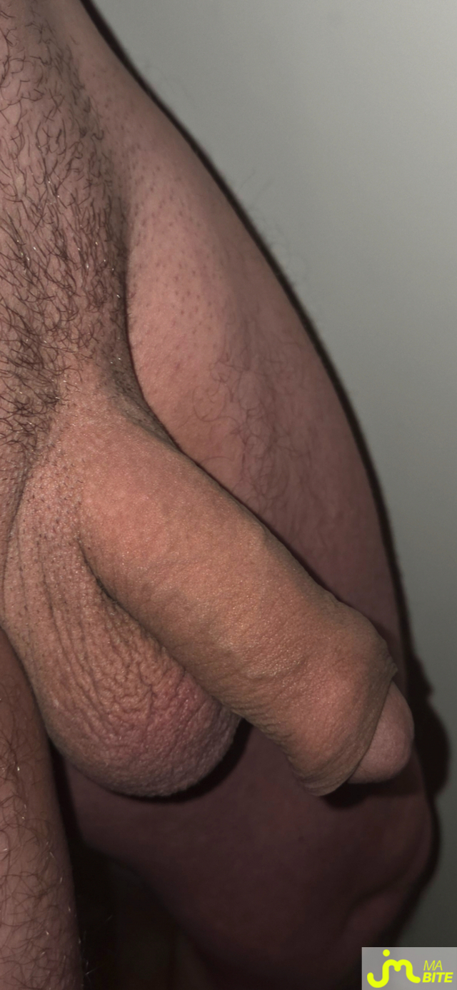 bites de Incognito14