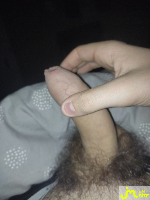 Photos de bites :  Evan Hemon 