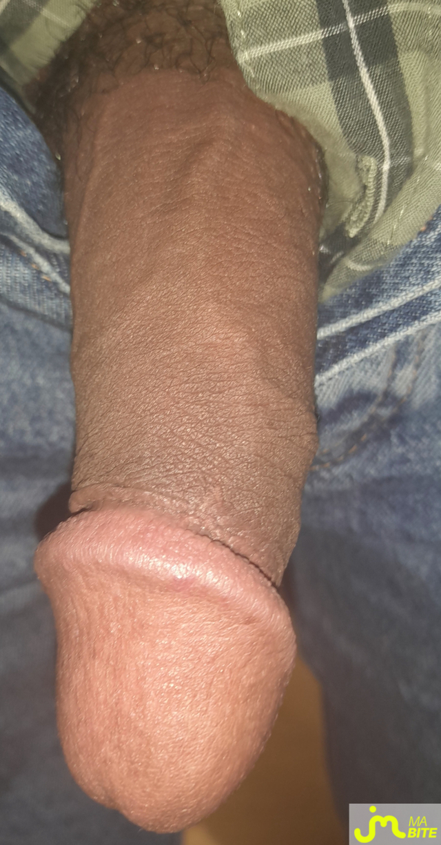 bites de Ericoup&eacute; 