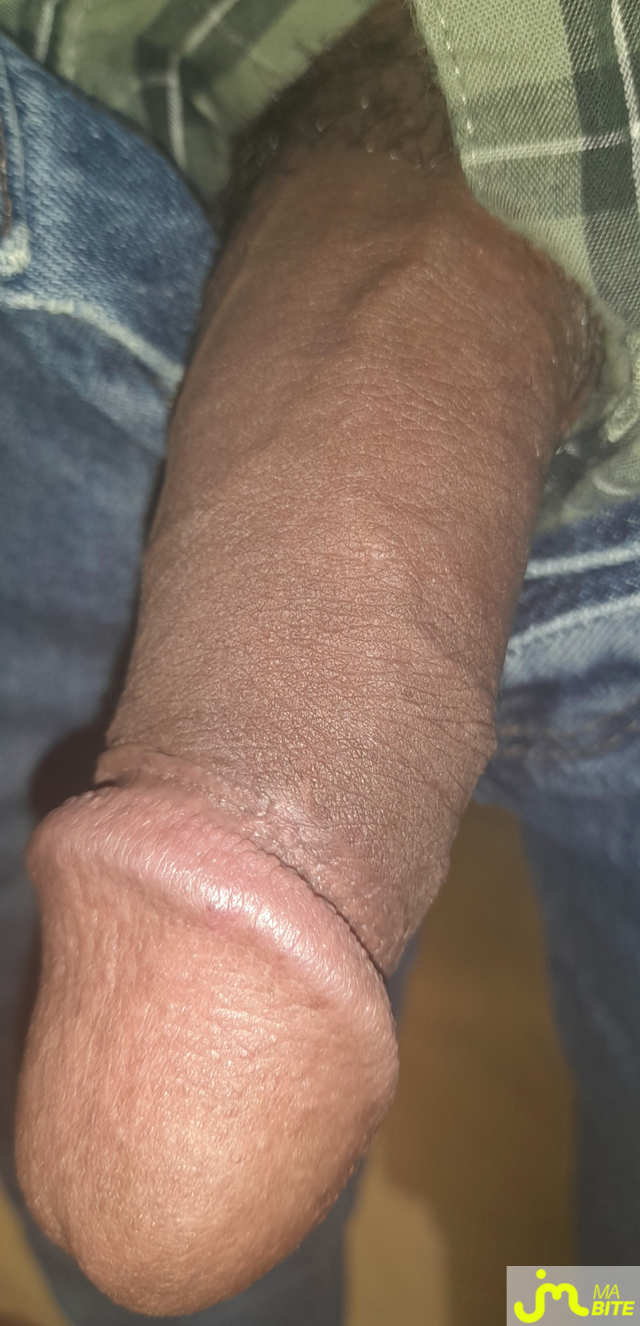 bites de Ericoup&eacute; 