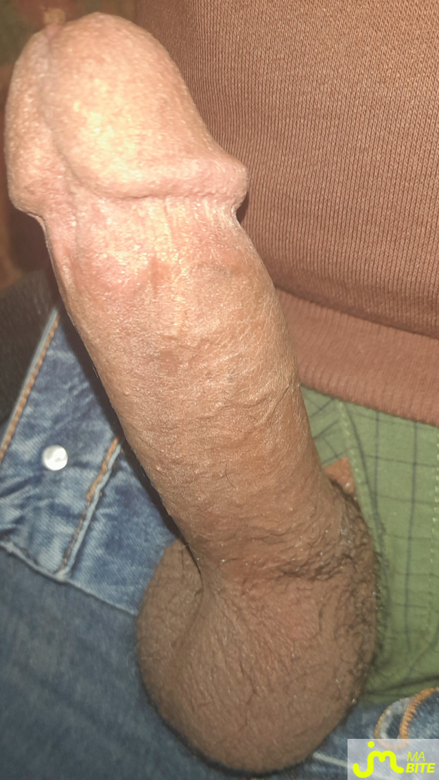 bites de Ericoup&eacute; 