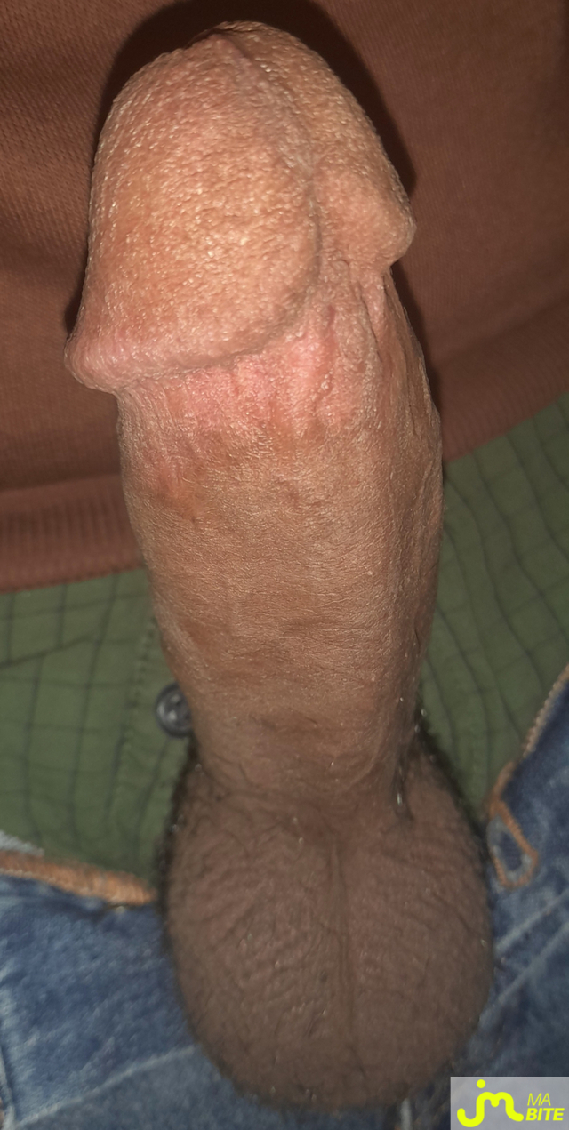 bites de Ericoup&eacute; 