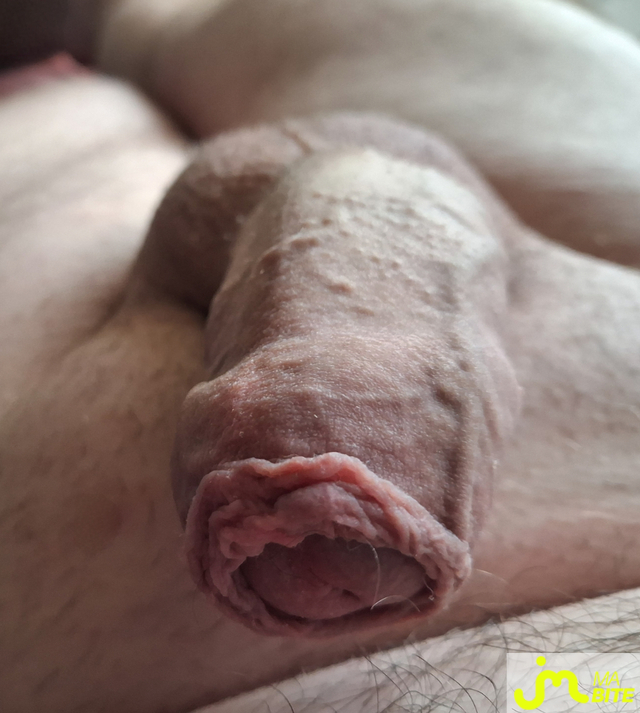 bites de Petitjouet76