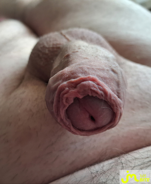 bites de Petitjouet76