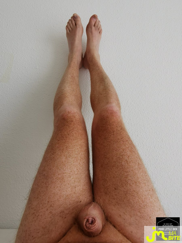 bites de ANAYSETORKA