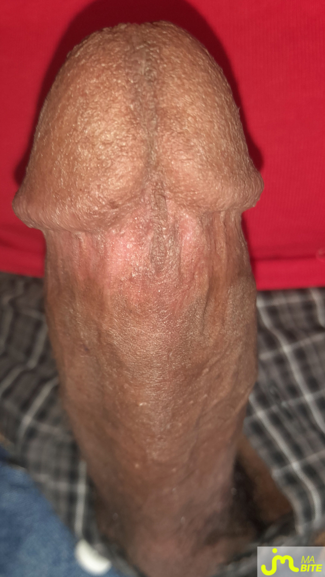 bites de Ericoup&eacute; 