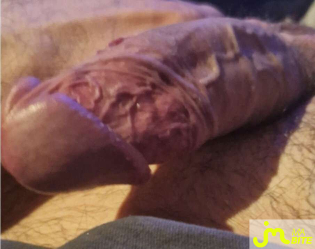 bites de Enzoooo30900gard