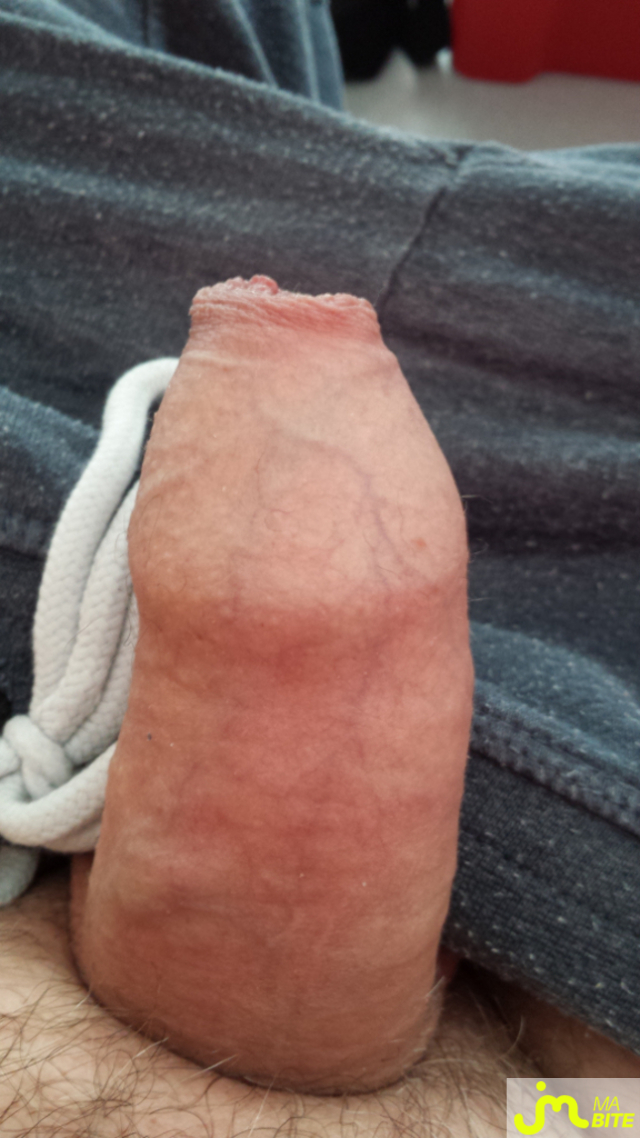 bites de close_up_zizi