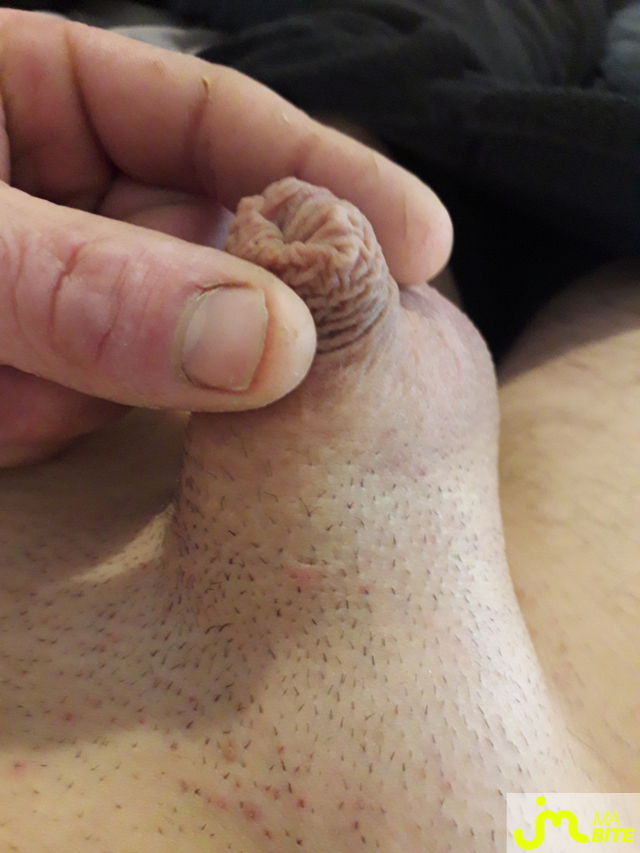 bites de Pilocer5637