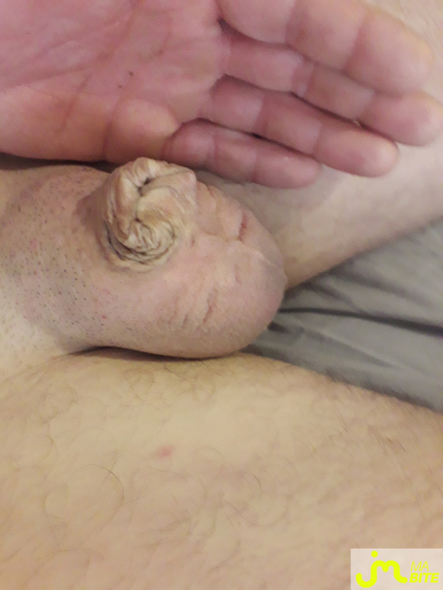 bites de Pilocer5637