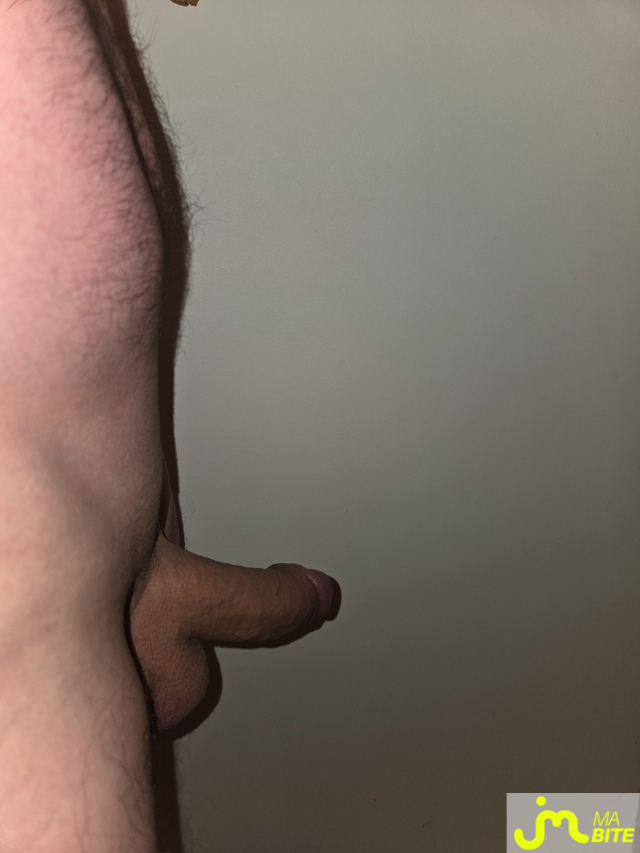 bites de Incognito14