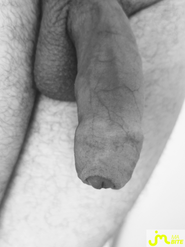 bites de Coucou_Ouep