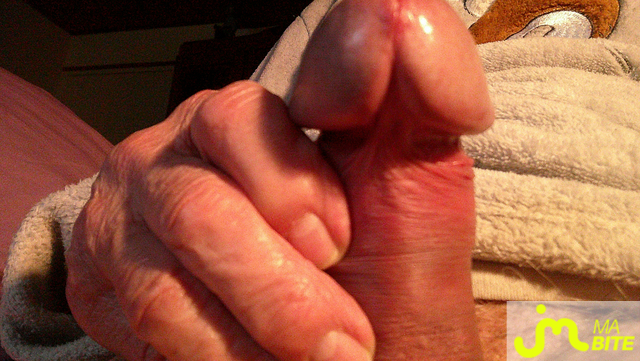 bites de jolie gland 