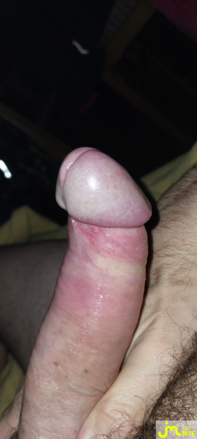 bites de Controleur67000